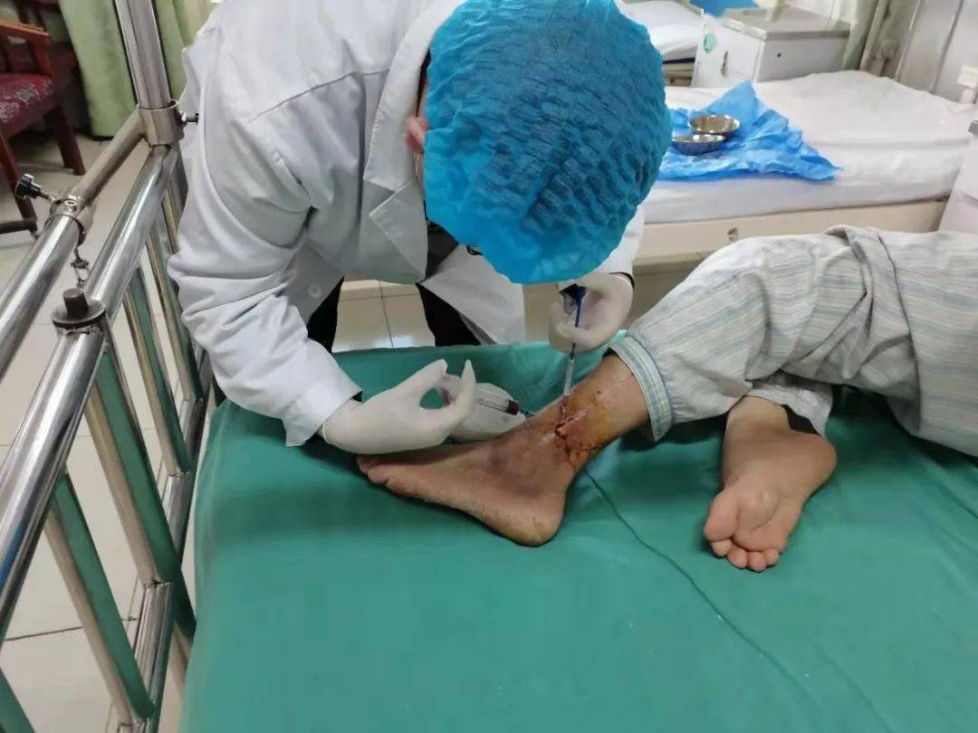 奇台县人民医院成功开展富血小板血浆治疗术