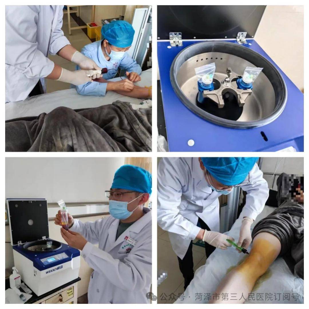 菏泽市第三人民医院常规开展PRP治疗，为骨关节炎患者带来新希望