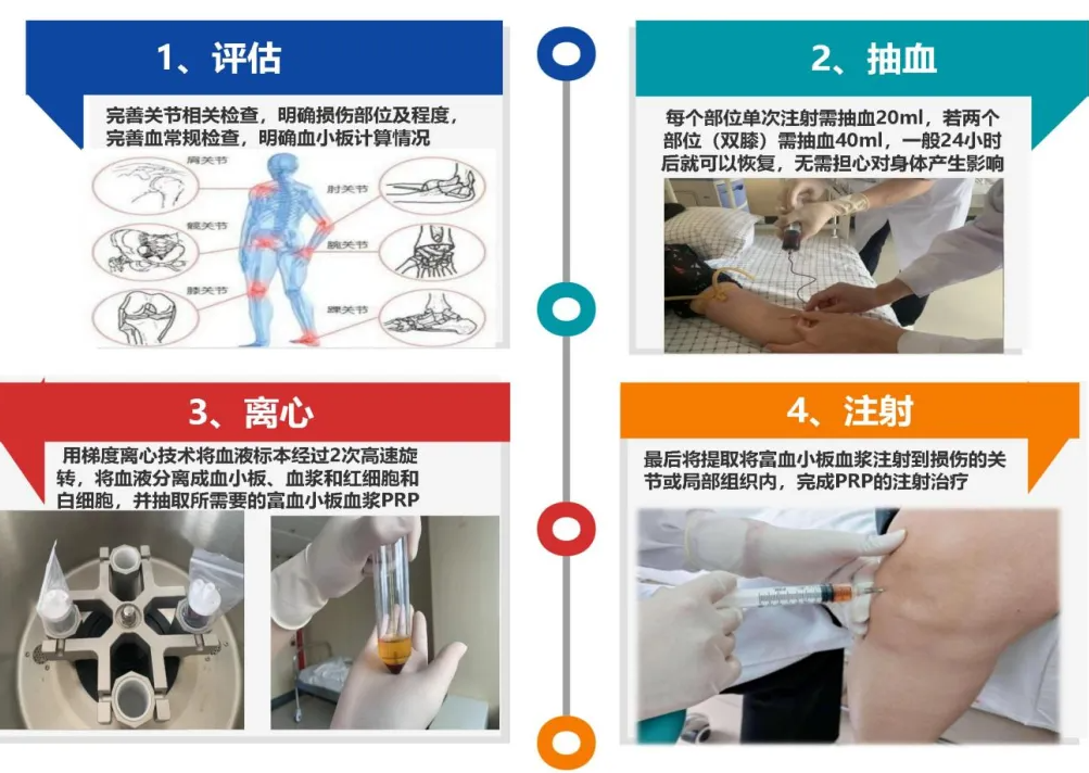 桂林医学院第二附属医院：神奇的“逆生长”，富血小板血浆技术，关节炎患者的福音