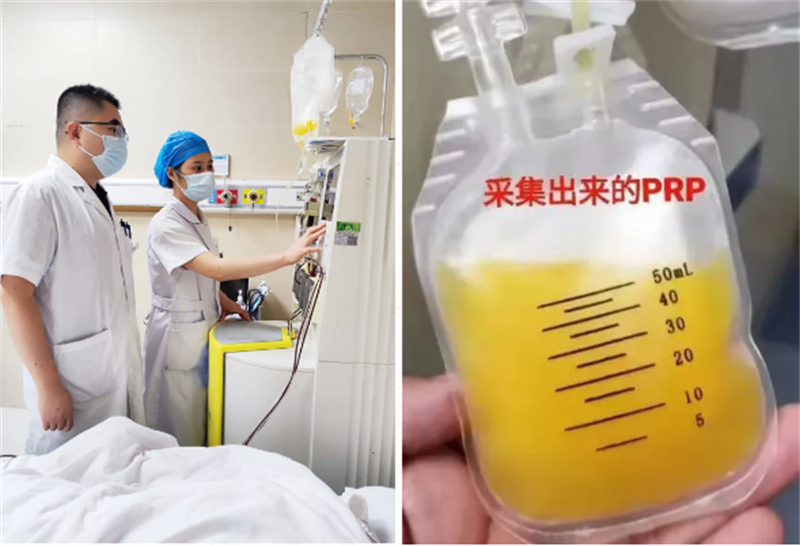用“自己的血液”为自己治疗——柳人医专家带您了解富血小板血浆（PRP）注射治疗
