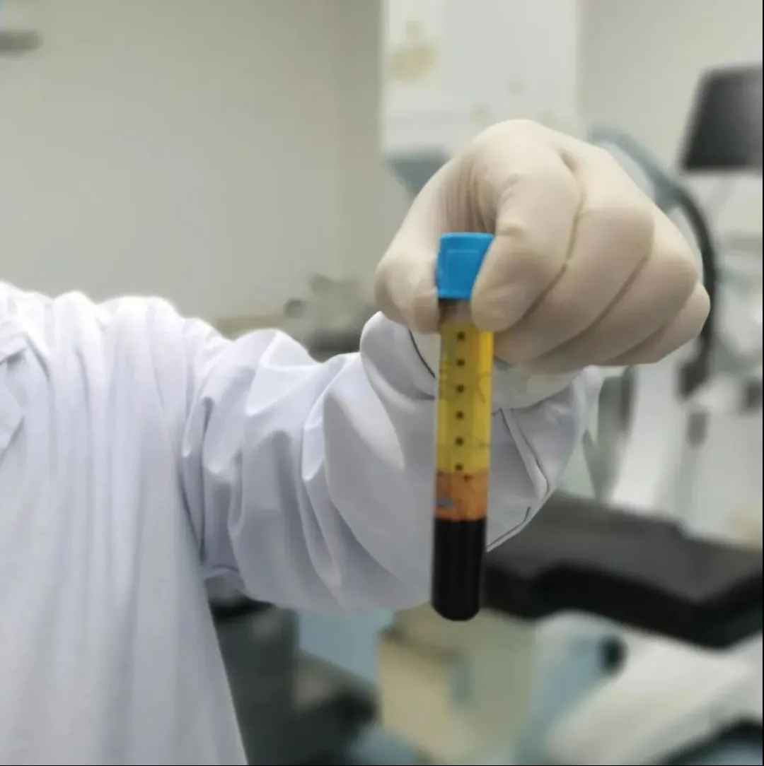 巫山县中医院：再生康复新技术——PRP（富血小板血浆）治疗