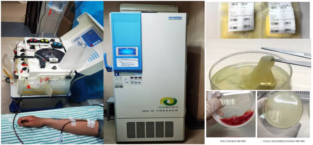 甘肃省中医院：为什么选择PRP？——富血小板血浆（PRP）的临床应用