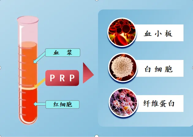 价格亲民+疗效确切，济南市莱芜人民医院PRP治疗值得信赖