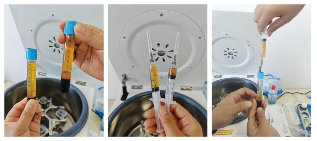 彰武县人民医院：膝关节损伤新疗法——疼痛科首例完成 PRP