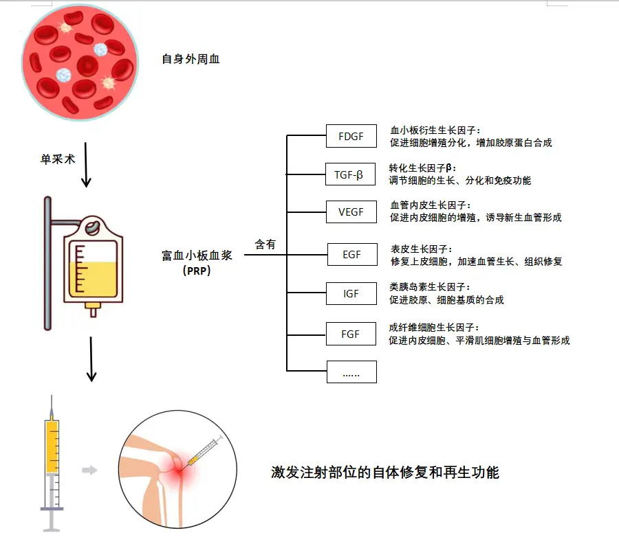 郑州市第三人民医院：膝盖痛？别忍了！看看这个技术说不定能帮到你
