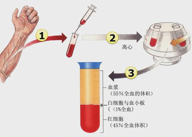 眉山心脑血管病医院：PRP治疗患者肘关节疼痛困扰多年后，又能重新“掌勺”了！