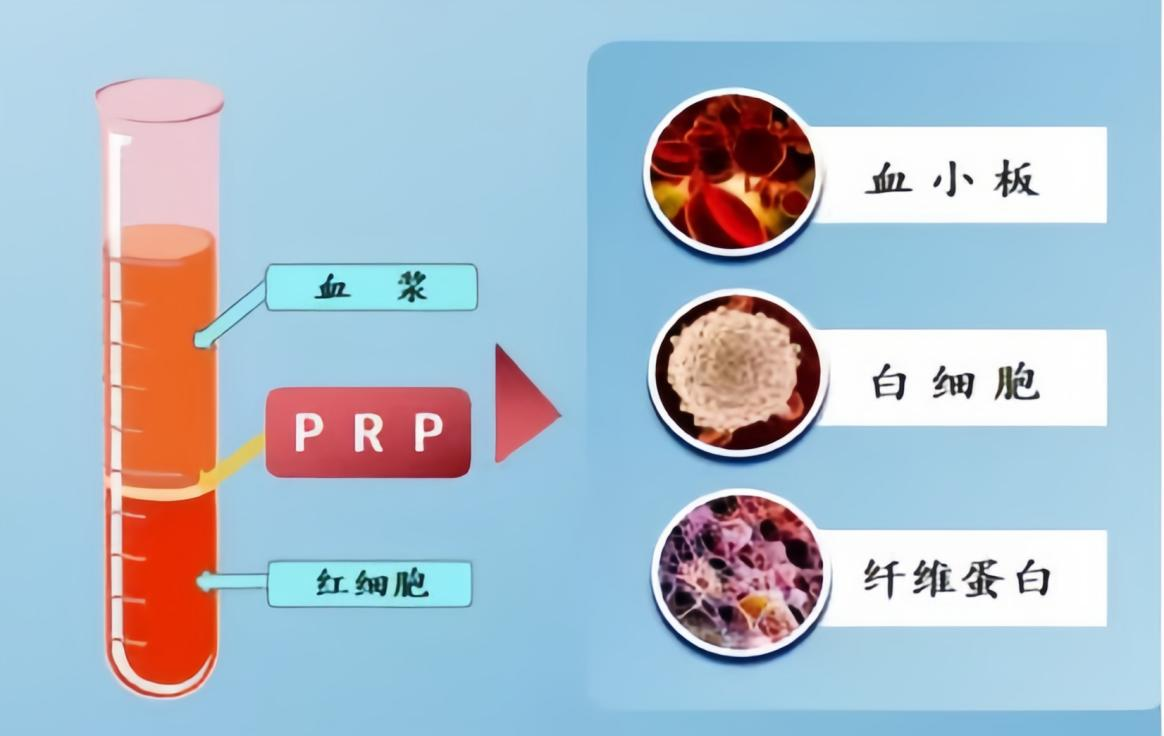 云南中医药大学第二附属医院骨伤科、疼痛科西医特色疗法-富血小板血浆（PRP）再生治疗技术