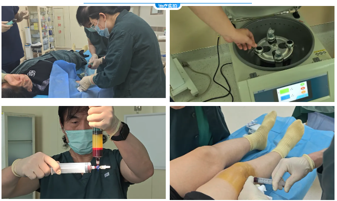 北京新起点中西医结合医院：用自己的血，治自己的病？——富血小板血浆（PRP）治疗术