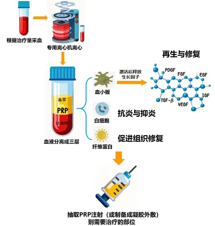 漯河市康复医院：膝关节骨性关节炎治疗的新选择：富血小板血浆治疗