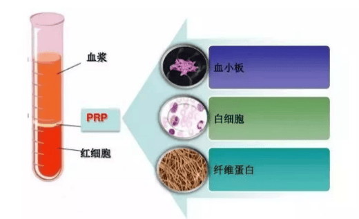 陆军第七十八集团军医院特色诊疗：人体自我修复工程师PRP富血小板血浆治疗