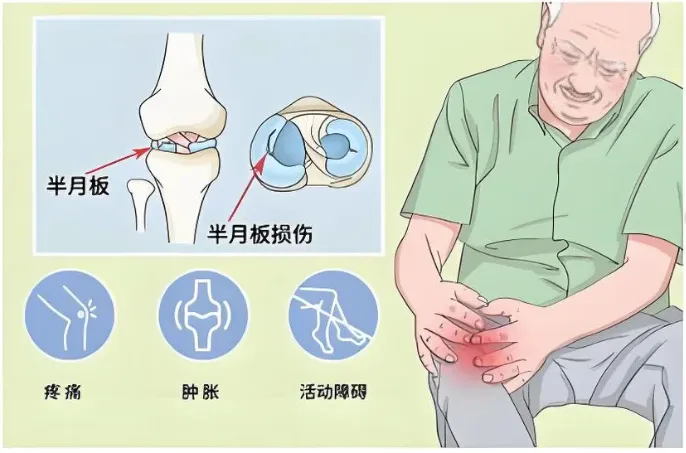 半夜膝盖脚踝疼怎么回事？合肥中山医院骨科PRP技术精准应对